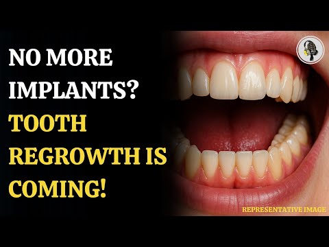 From Sharks to Smiles: Human Tooth Regrowth Trials Begin! | WION Podcast