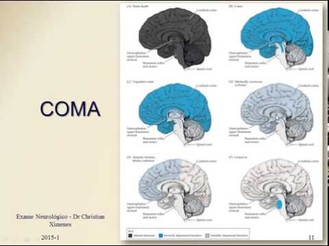Semiologia Neurológica -