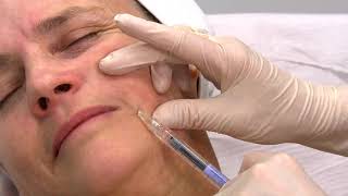 Injection Acide Hyaluronique