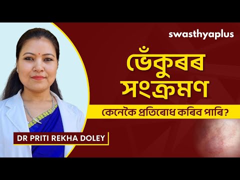 ভেঁকুৰৰ সংক্ৰমণ: কেনেকৈ প্ৰতিৰোধ কৰিব পাৰি? | Fungal Infection in Assamese | Dr Priti Rekha Doley
