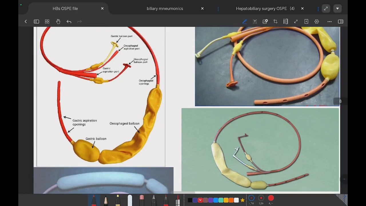 HB surgery | Hepatobilliary tubes ( OSPE )