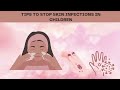 Tips to stop skin infection in children