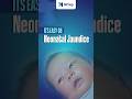 Neonatal Jaundice in hindi (It's EASY 08) #nursingofficer #norcet11