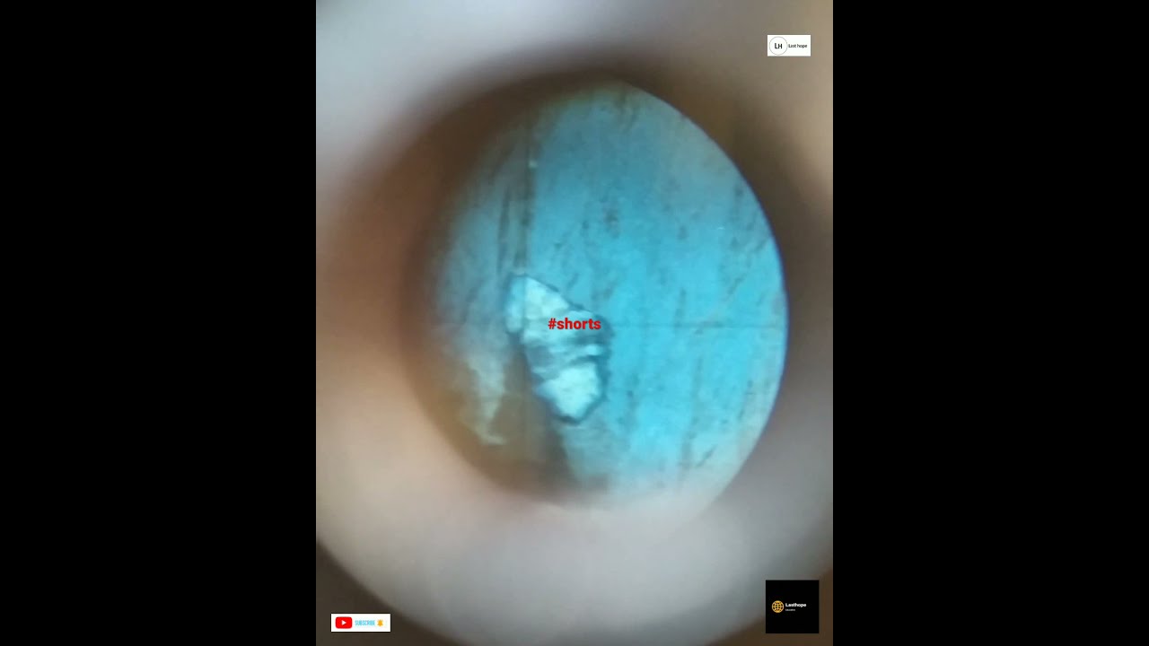 Perthite texture under microscope | #Shorts | #Lasthope - YouTube
