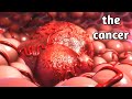 شاهد كيف يتكون السرطان داخل الجسم                                         