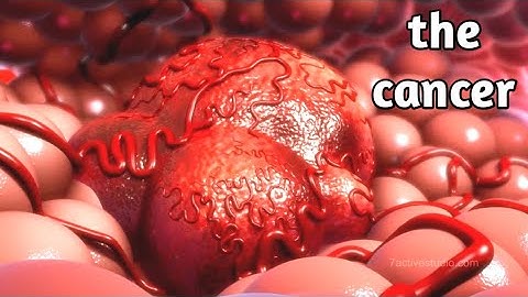 شاهد كيف يتكون السرطان داخل الجسم - Watch how cancer forms inside the body
