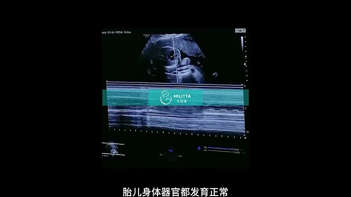 厦门H女士因为卵巢早衰，加上患有子宫畸形迫于无奈选择乌克兰代孕，现在她的代妈到妇产医院做了四维彩超检查，胎儿身体器官都发育正常，五官已经清晰可见！ - 天天要闻