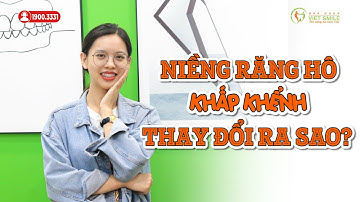 Thay đổi ra sao sau 1 năm niềng răng hô, khấp khểnh - KH Như Ý