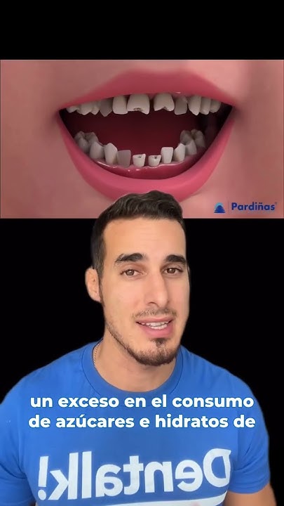 DIENTES PODRIDOS en niños por no lavarse y acudir al DENTISTA - YouTube