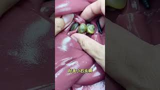 So Many Little Stones #Stress Relief Video #Digging for Surprises in Soft Slime #Crystal S