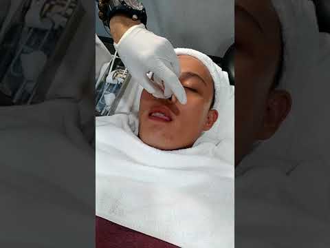 What Suntikan Filler Punggung