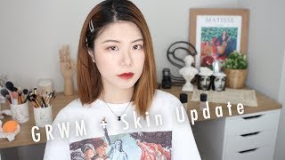 GRWM • 异维A酸停药大半年肤况更新skin update | Sylvia黄瓜瓜