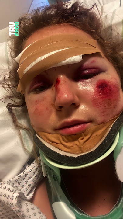 Motorradunfall: Leni (28) überlebt wie durch ein Wunder | TRU DOKU #Motorradunfall #trudoku #funk