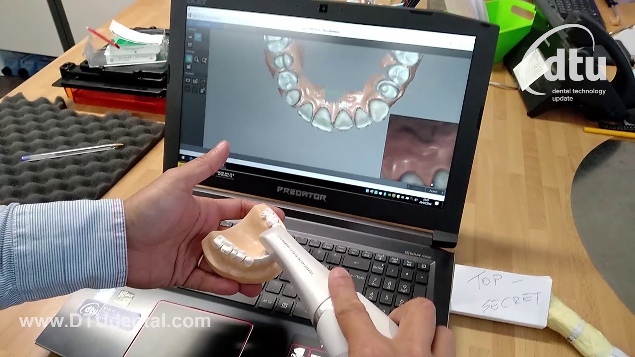 Carestream CS 3600 Stand Alone without AC Power Adapter
