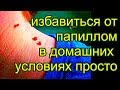 как избавиться от папиллом , в домашних условиях / удалить бородавки без хирурга. / топ5хайп