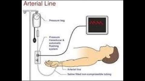 SALINE MONITORING SYSTEM