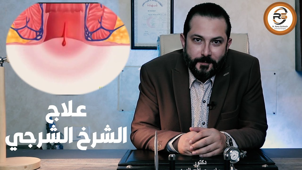 لو انت بتعاني من الشرخ الشرجي .. اعرف اكتر عن الشرخ الشرجي و طرق علاجه مع د #رامي_صلاح_الدين