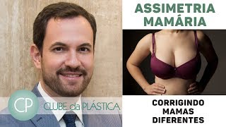 Clube da Plástica: Corrigindo mamas diferentes