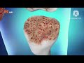 Quảng cáo JEX Max - Giúp Giảm Đau Tái Tạo Sụn Khớp Và Xương Dưới Sụn