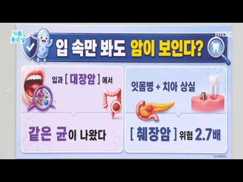 [Good Day] Can you spot cancer just by looking inside your mouth?, Broadcast on MBC 09/07/26