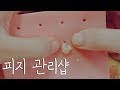 피지 관리샵 상황극 ｜ASMR｜Squeezing Sebum roleplay