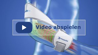 Masalo Manschette gegen Tennisarm, Golferarm, Mausarm (Epicondylitis) | Informationsvideo