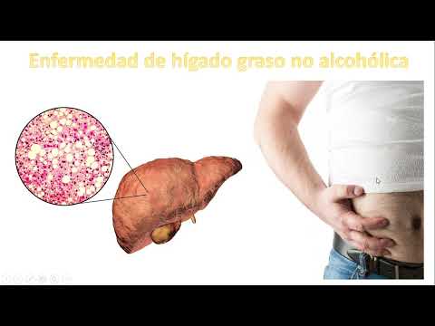 ENFERMEDAD DE HÍGADO