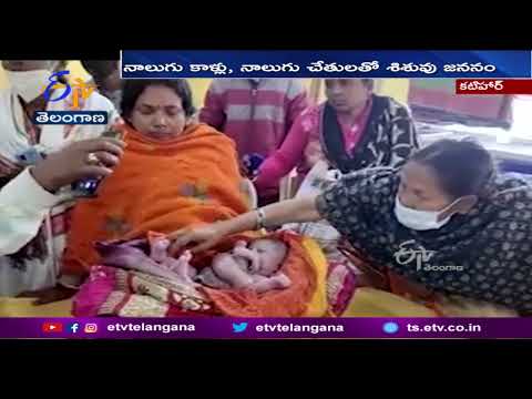 Baby Born With Four Legs & 4 Hands In Bihar  |  బిహార్ కటిహార్ జిల్లాలోఅరుదైన శిశువు జననం