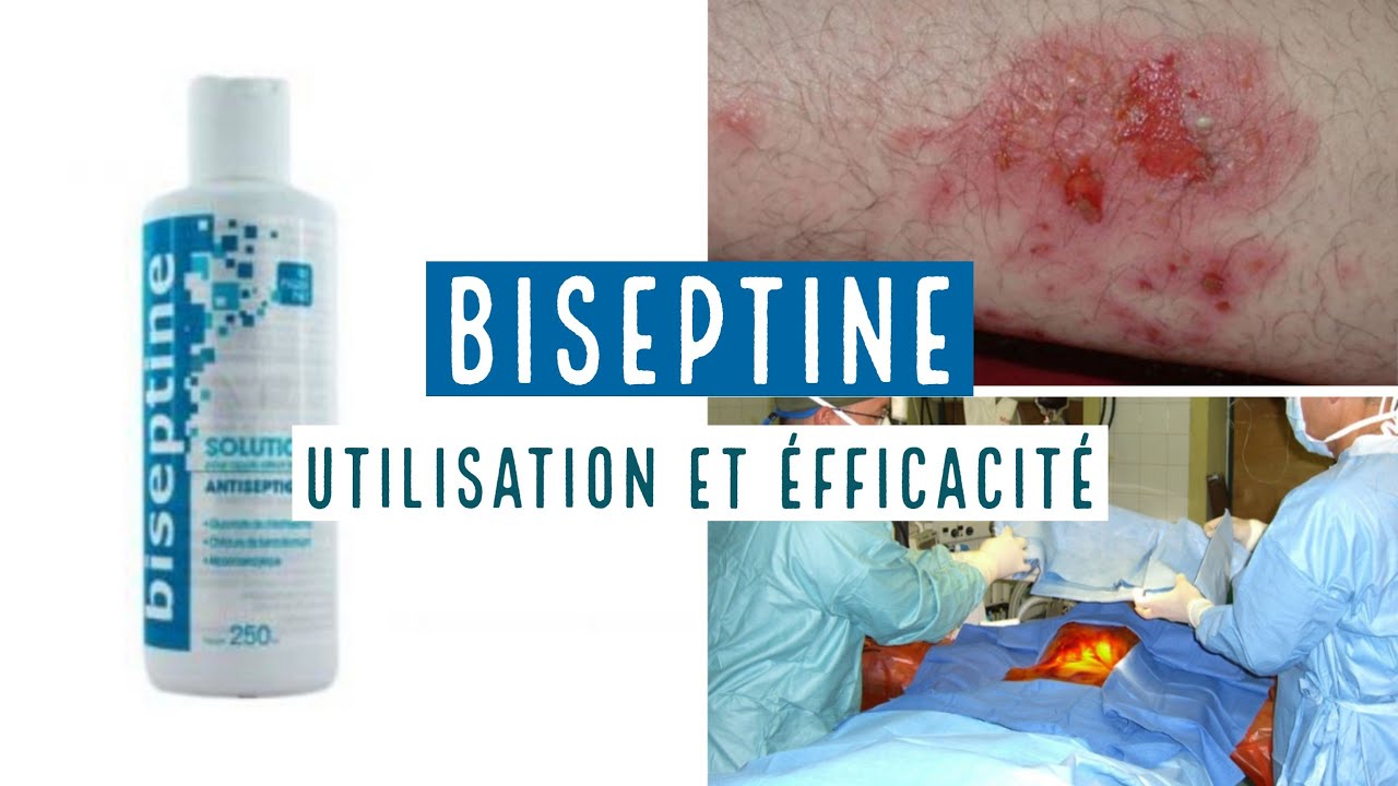 BISEPTINE - TOUT CE QUE VOUS DEVEZ SAVOIR 