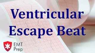 Ventricular Escape Beat ECG - EMTprep.com
