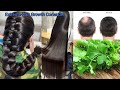 30 Days Challenge | How To Cure Baldness in Male And Female/ Coriander Hair Toner And Hair Oil