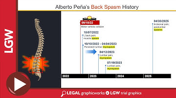 Personal Injury Timeline PowerPoint Animated Trial Graphics
