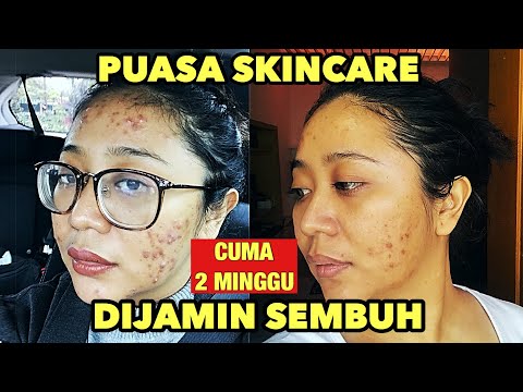 Hallooo semua happy watching^^ Yang aku dapetin dari hasil pemakaia rangkaian skincare dari L'Oreal . 