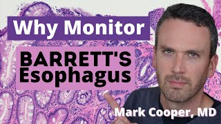 Barrett's Esophagus - Is MONITORING for Esophageal Cancer Worth the Risk?