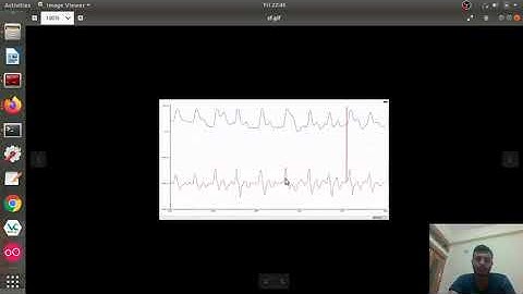 17EC01015-LAB 2 | Filters(Continued)