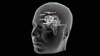 Depth Electrodes with Outer Skin