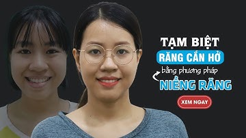 [Review niềng răng] - Kết quả niềng răng cắn hở của Ngọc Mai
