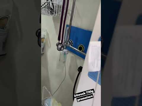 منداڵی ٢٤ هەفتەیە پێش کاتی خۆی لە دایک بوو Premature Baby 24 Weeks طفل خديج عمره 24 أسبوع