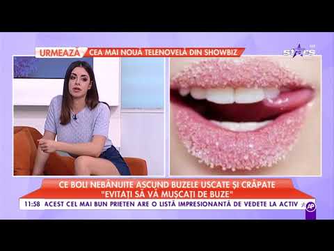 Video: Buze De Sarcină: Modificări Uscate, Umflate, Prăbușite și Alte Modificări Ale Buzelor