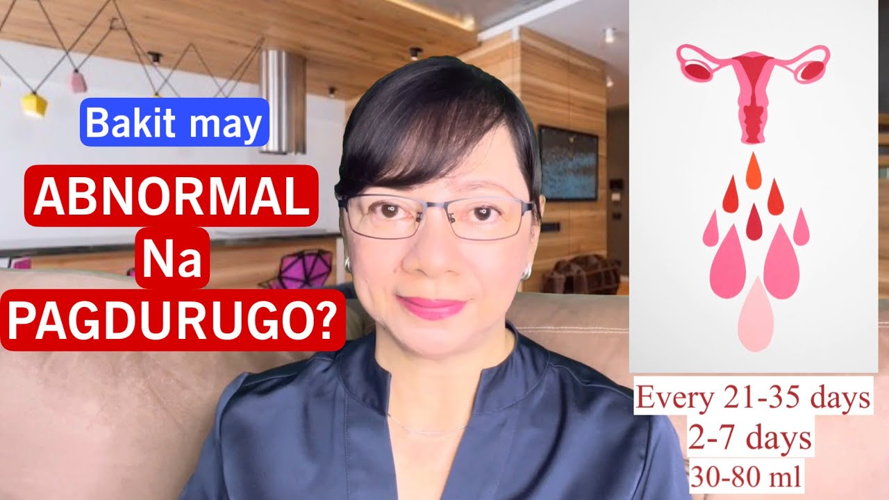 Bakit Malakas ang Pagdugo? Ob-Gyne Vlog 250
