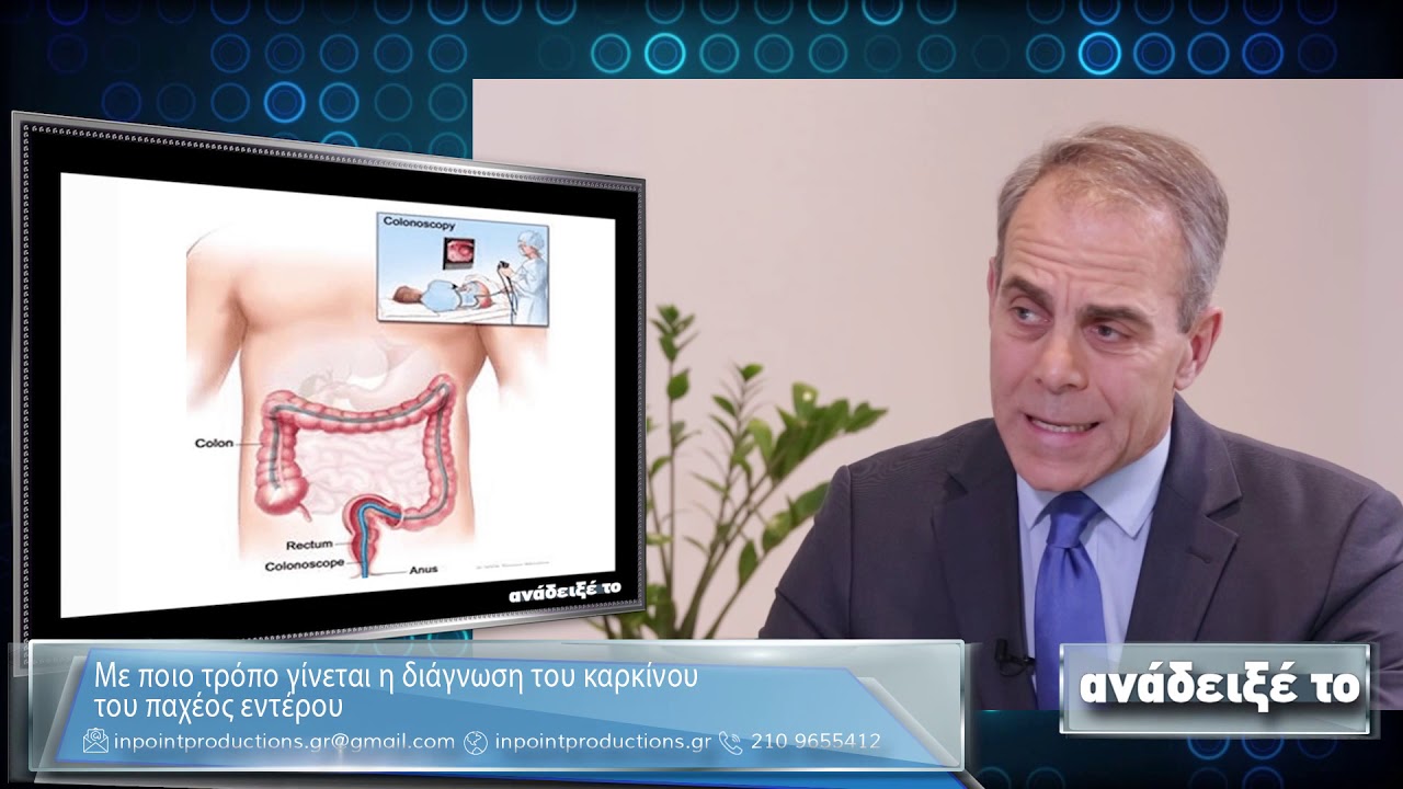 Καρκίνος του παχέος εντέρου: Από την πρόληψη στην θεραπεία - Ιωάννης Βίρλος