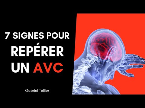 7 signes pour reconnaitre un AVC facilement