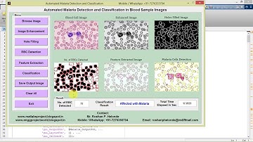Matlab Code for Malaria Detection and Classification in Blood Sample Images