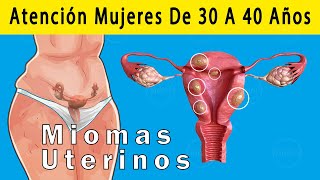 15 Cosas Que Debe Saber Sobre Los Miomas Uterinos Y Su Tratamiento