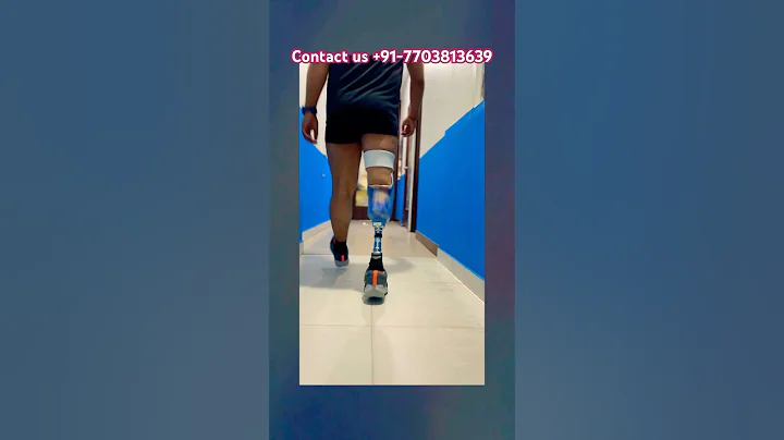 Below Knee Artificial leg Best price | #ossur #artificiallimb #nakli #love #prostheticlimb #fyp