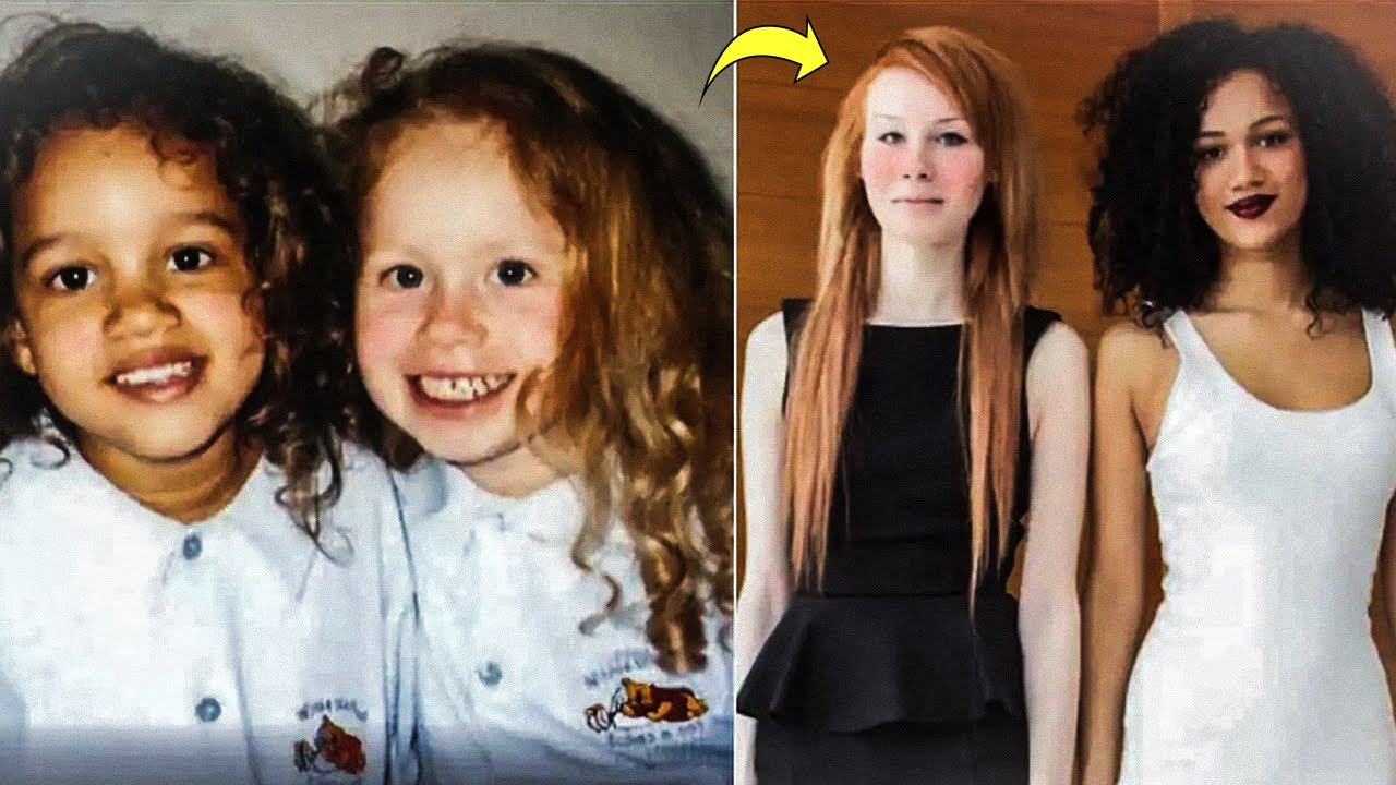 Mom’s Twins Were Once Alike 18 Years Later, Their Lives Took Shocking