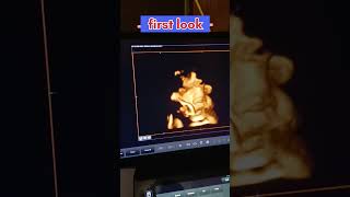 my baby first encounter #shorts #junior #trendingshorts