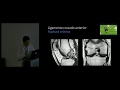 Anatomía y patología de ligamentos cruzados y mecanismo extensor. Dr. Ricardo Álvarez Pérez.