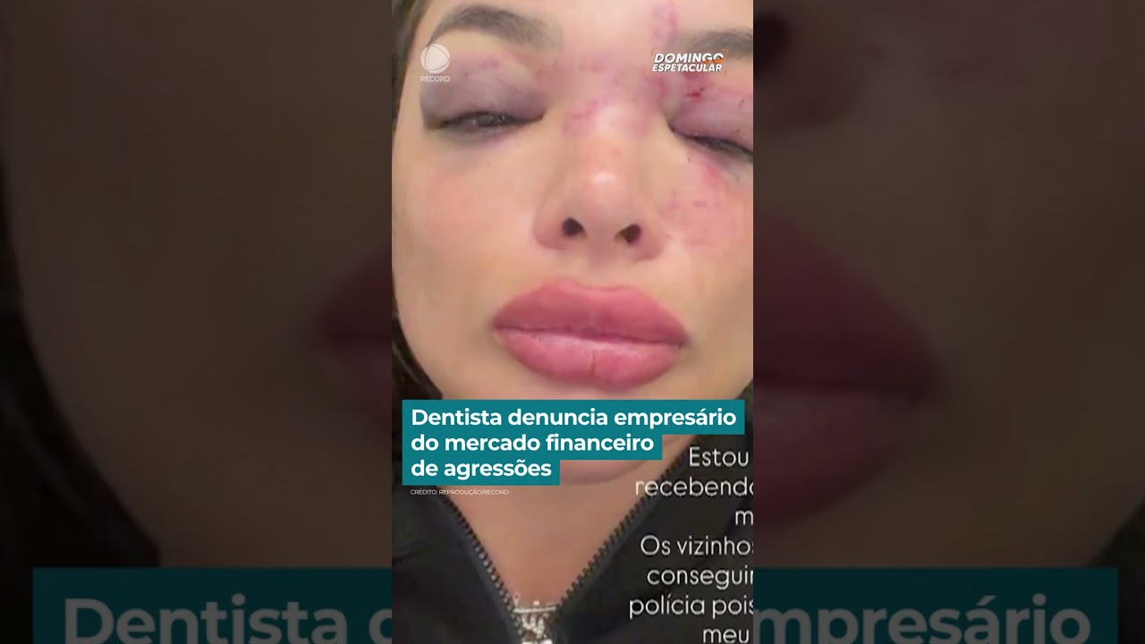 Imagem ilustrativa sobre Empresário oferece Pix ao dentista para 'sumir' após agressão