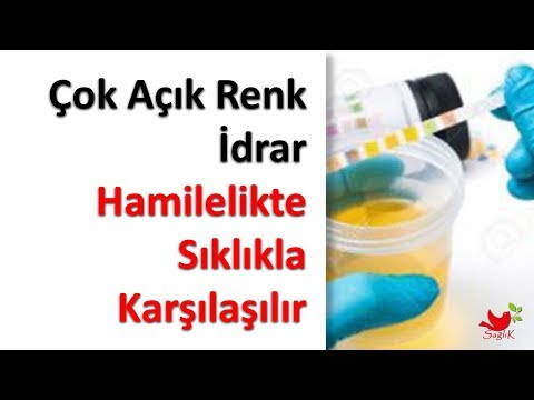 Çok Açık Renk İdrara Hamilelikte Sıklıkla Karşılaşılır